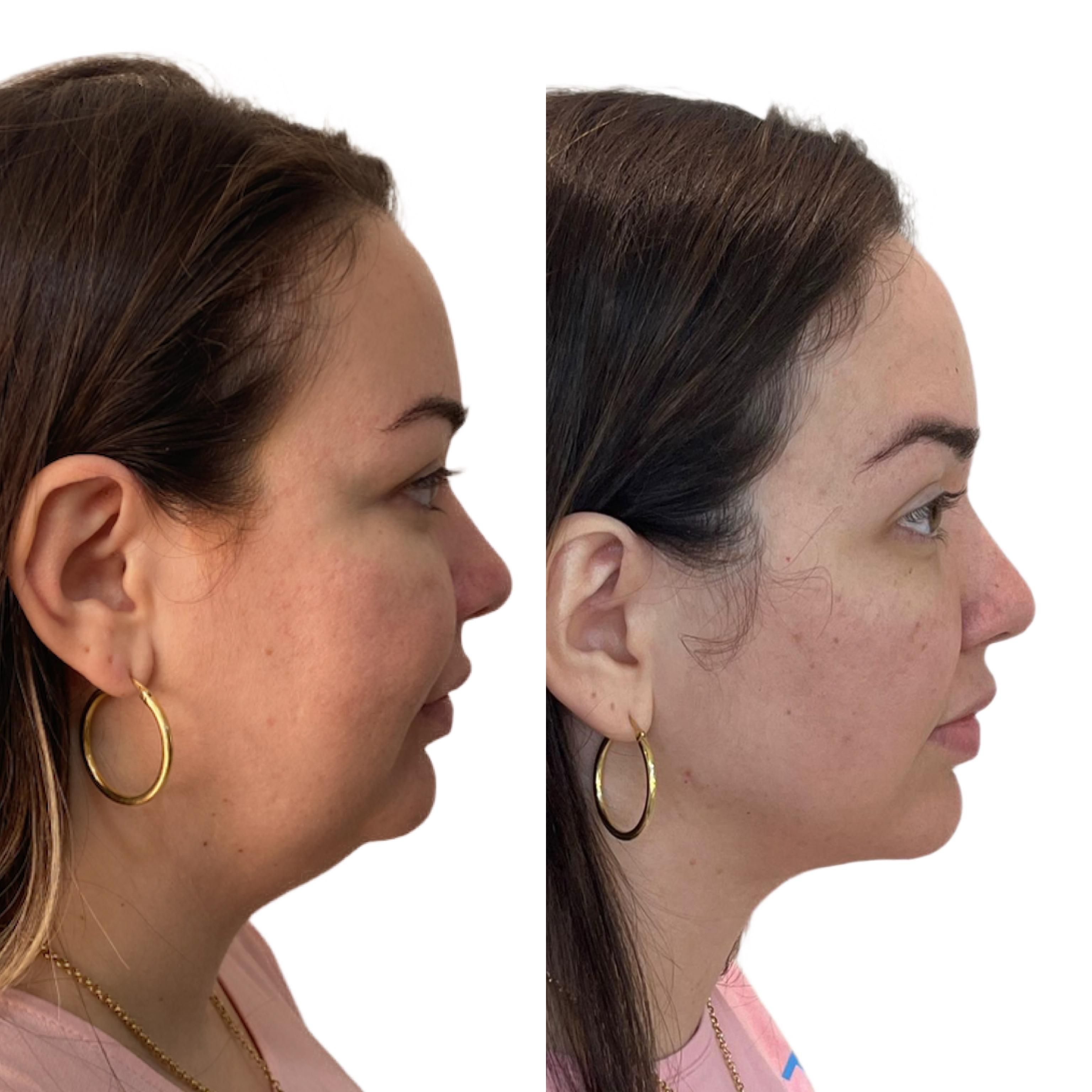 Descrição do caso 3