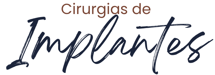 Implantes dentários